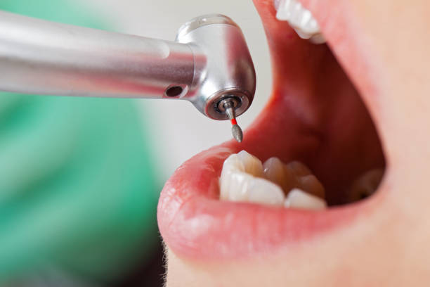 Best Emergency Treatment for Toothache in Conashaugh Lakes, PA